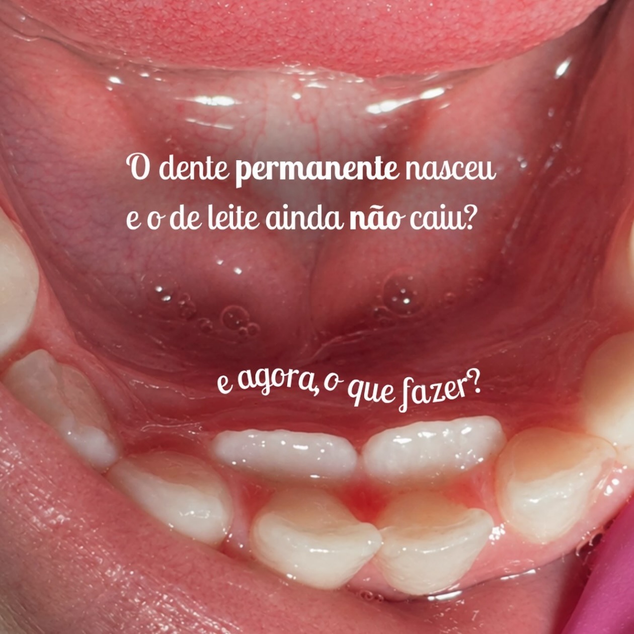 Registro de atendimento odontológico